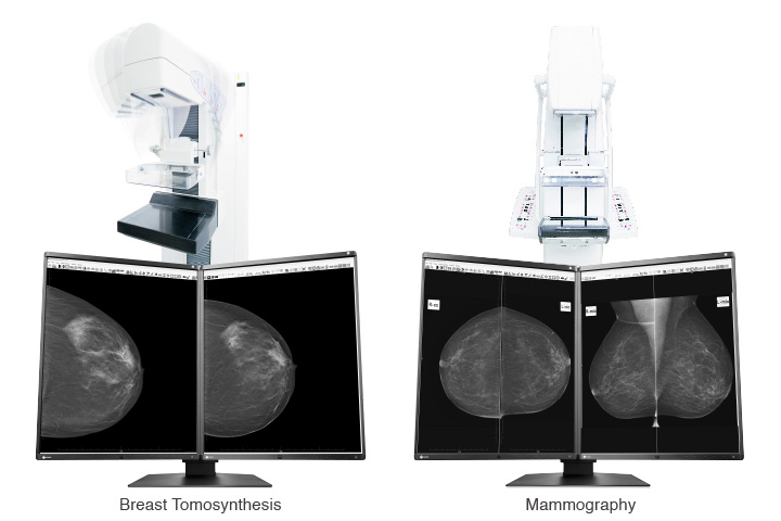 TomosynthesisMammography